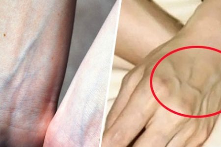 Nhìn thấy ai có “gân xanh” nhất định phải nói cho họ biết điều này vì nó sẽ cứu sống người đó, cứu 1 mạng người hơn xây 7 tòa tháp
