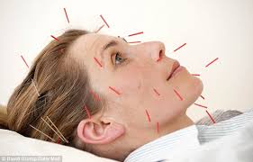 10 Cách chữa bệnh đau đầu nhanh nhất tại nhà 3