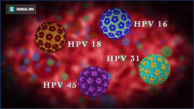 Ung thư cổ họng do virut HPV gây nên ở nam giới nhiều hơn ung thư cổ tử cung ở nữ giới